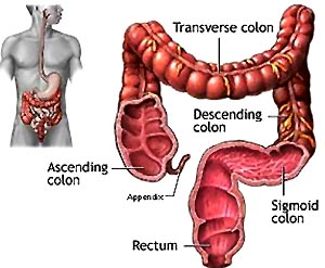 Colonic Hydrotherapy Weight Loss, Colon Cleanse Weight Loss, Colonics Cost, Kevin Trudeau Weight Loss, Colonics Procedure, Colonics Lose Weight, Colonics Benefits, Colonix Weight Loss