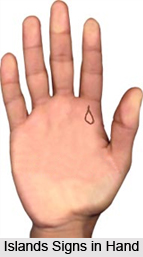 Islands Signs in Hand, Palmistry
