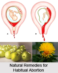 Natural remedies for abortion