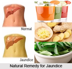 Natural Remedy for Jaundice, Indian Naturopathy