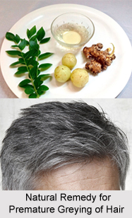 Natural Remedy for Premature Greying of Hair, Indian Naturopathy