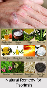 Natural Remedy for Psoriasis, Indian Naturopathy