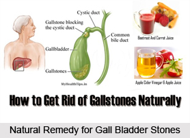 Natural Remedy for Gall Bladder Stones, Indian Naturopathy