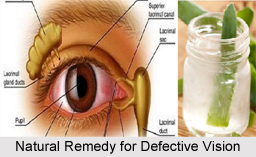 Natural Remedy for Defective Vision, Indian Naturopathy