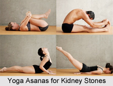 Natural Remedy for Kidney Stones, Indian Naturopathy