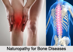 Naturopathy for Bone Diseases, Indian Naturopathy