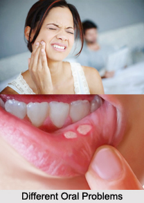 Naturopathy for Oral Problems, Indian Naturopathy