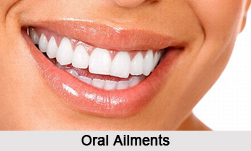 Oral Ailments, Naturopathy