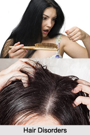 Hair Disorders, Naturopathy
