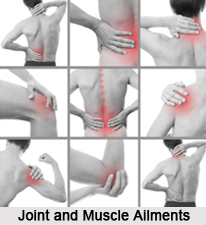 Joint and Muscle Ailments, Naturopathy