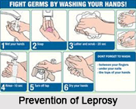 Leprosy, Naturopathy