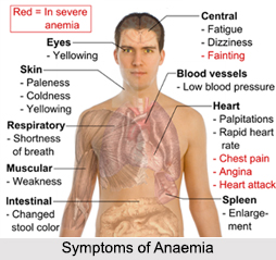 Anaemia, Naturopathy
