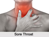 Sore Throat, Naturopathy