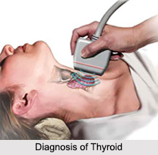 Thyroid Disorder, Female Disease