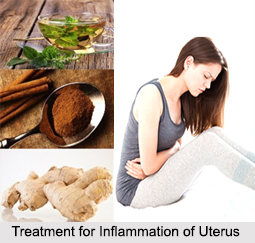 Inflammation of Uterus, Female Disease
