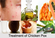 Chicken Pox, Infectious Disease