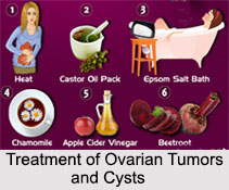 Ovarian Tumors and Cysts, Female Disease