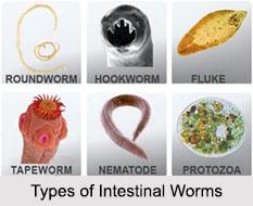 Intestinal Worms, Stomach Ailment