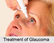 Glaucoma, Eye Disorder