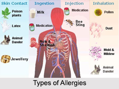 Types of Allergies, Naturopathy