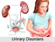 Urinary Disorders, Common Ailments