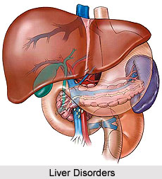 Causes of Liver Disorders