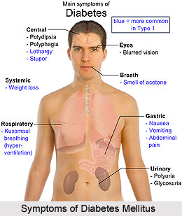 Symptoms of Diabetes Mellitus