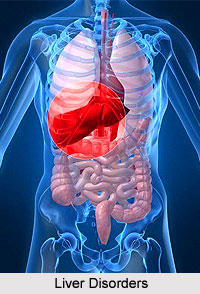 Types of Liver Disorders