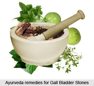 Treatment of Gall Bladder Stones