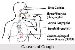 Causes of Cough