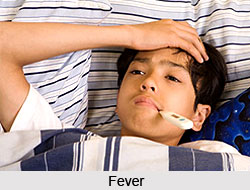 Common Fever