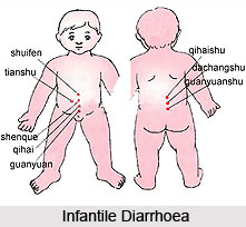Infantile Diarrhoea