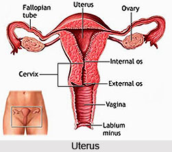 Treatment of Inflammation of the Uterus