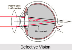 Defective Vision
