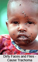 Trachoma or Pothaki