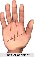 Lines of Accident, Palmistry