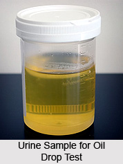 Oil Drop Test in Urine Therapy
