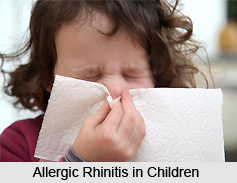 Allergic Rhinitis, Allergic Disease