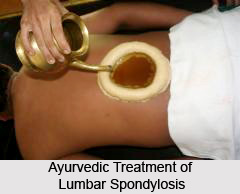 Treatment of Lumbar Spondylosis