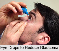 Treatment of Glaucoma