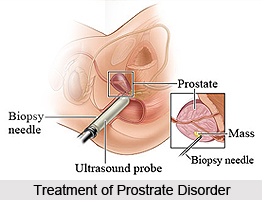 Treatment of Prostrate Disorder