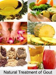 Gout, Bone Ailment