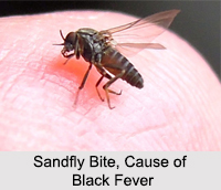 Black Fever or Kala Jwara