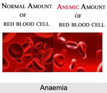 Anaemia, Naturopathy