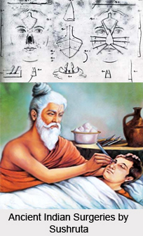 Ancient Indian Surgery, Ancient Literature of Ayurveda