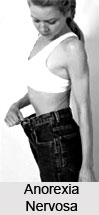 Anorexia Nervosa