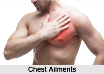 Chest Ailments, Naturopathy