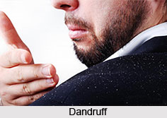 Dandruff