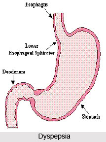 Dyspepsia or Agnimandya