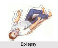Epilepsy, Neurological Disorder